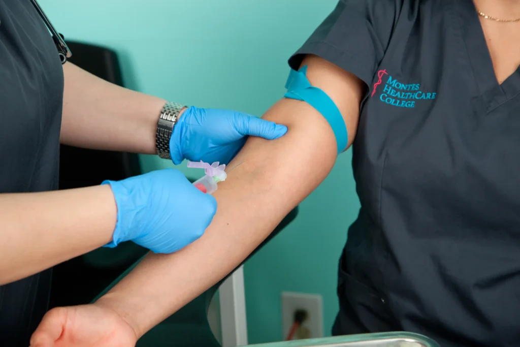 When It’s Difficult to Draw Blood: Tips from Phlebotomists
